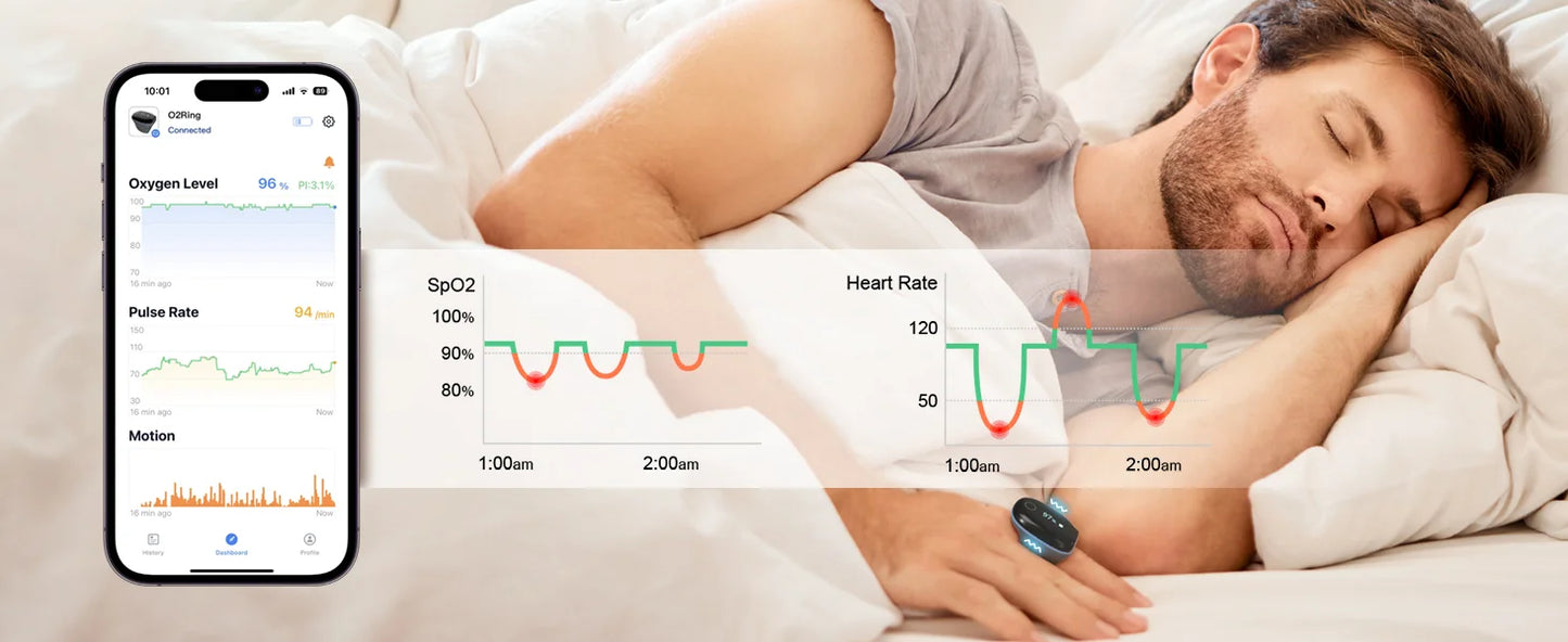 Wellue O2ringS Bluetooth Sleep Monitor Health Monitoring Ring SpO2 Sensor Digital Pulse Oximeter